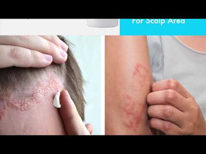 Blue Cap range of products is your best defense for Psoriasis, Eczema, and other skin diseases